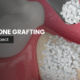 What to Expect with Dental Bone Grafting