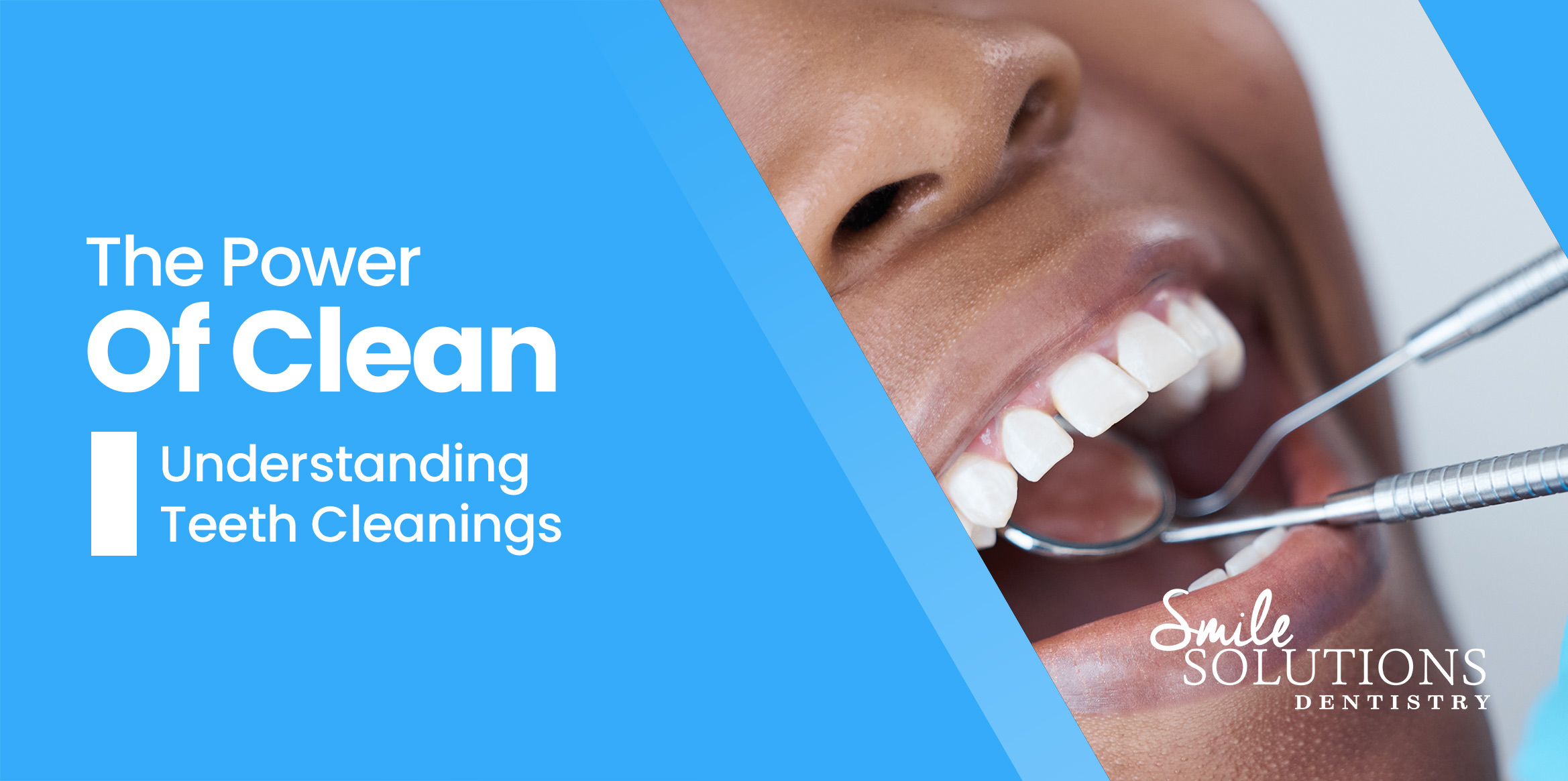 Understanding Teeth Cleanings