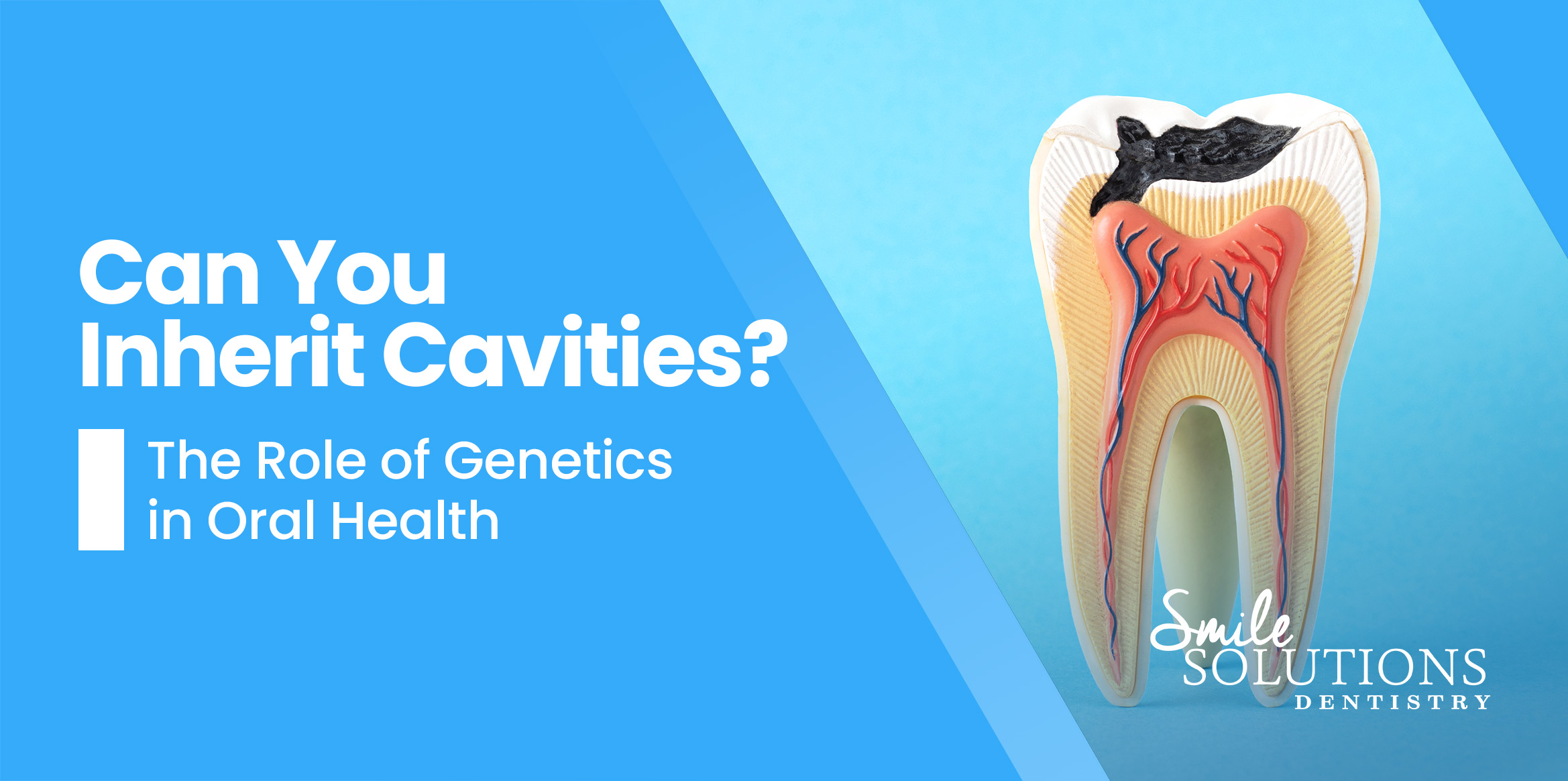 cavities and genetics