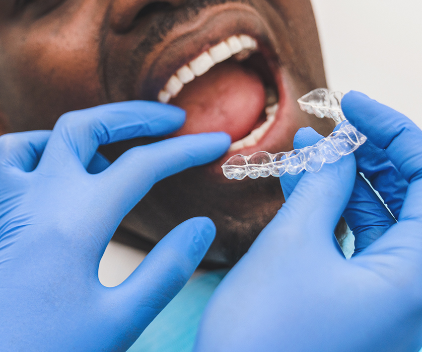 Invisalign in kannapolis