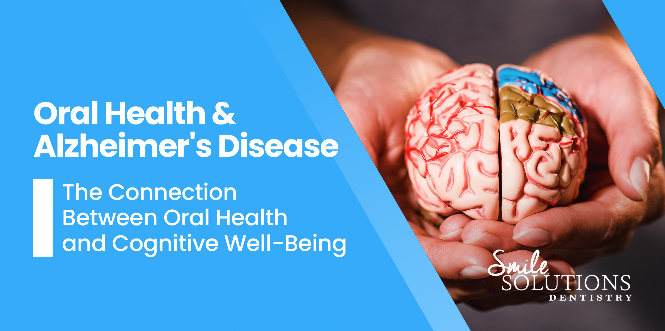 Oral Health and Alzheimer's