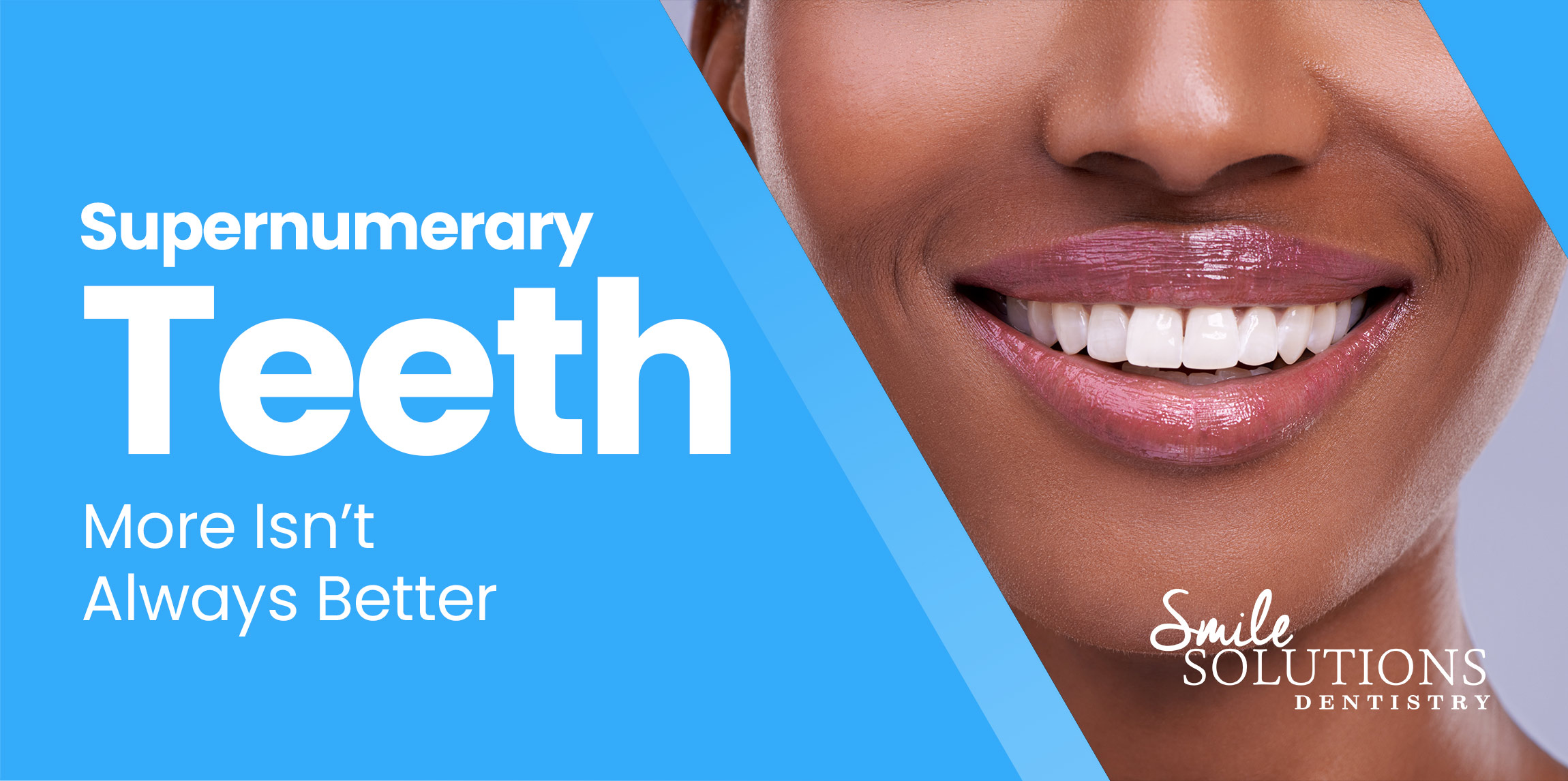 Supernumerary Teeth